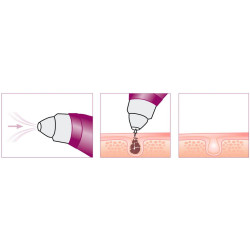 Очиститель пор Beurer FC 41 (White/Purple) Thumb