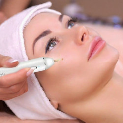 Aparat indepartare papiloame/pete/negi Xpreen 125952 (White) Thumb