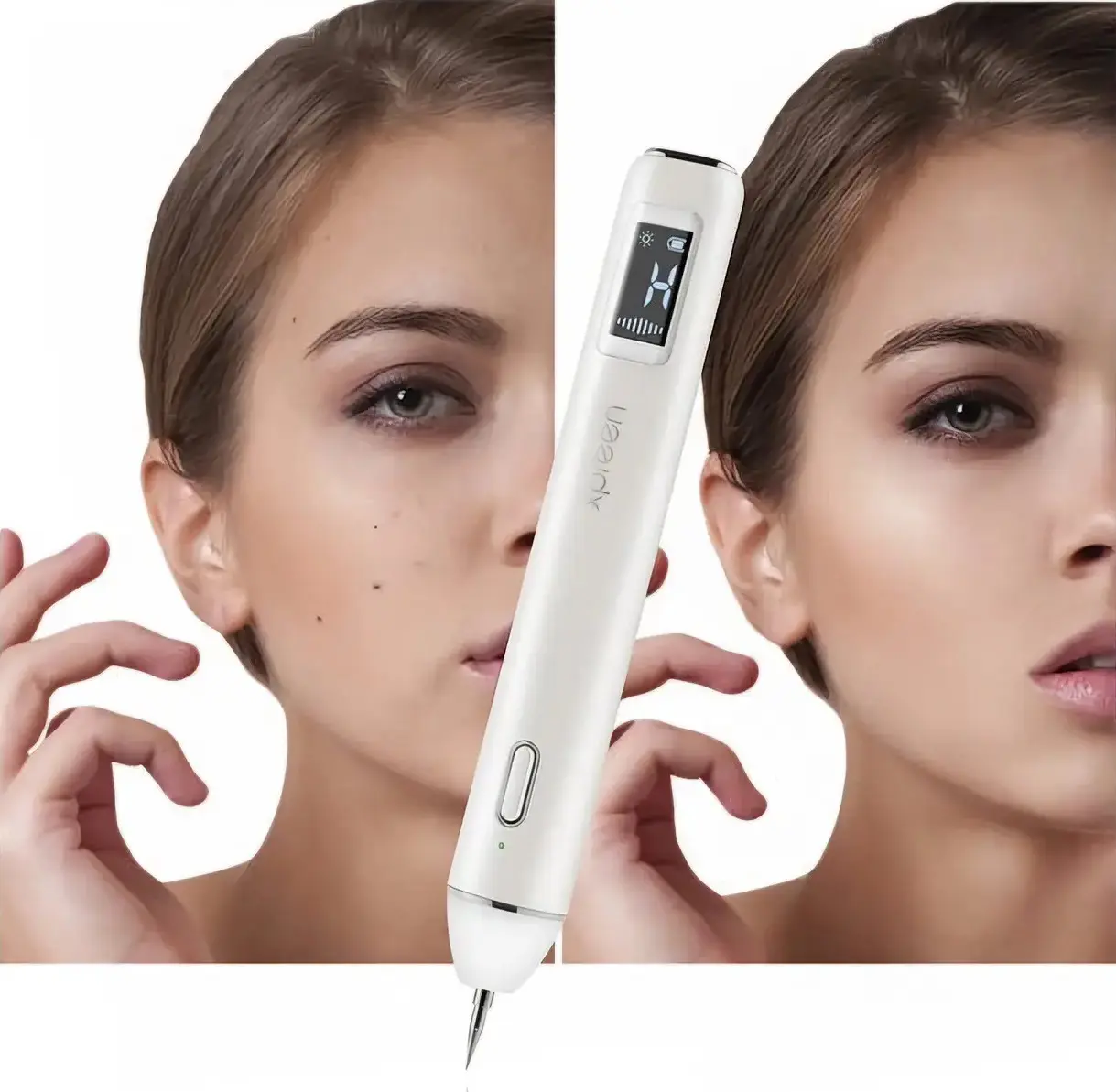 Aparat indepartare papiloame/pete/negi Xpreen 125952 (White)