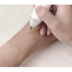 Aparat indepartare papiloame/pete/negi Xpreen 125952 (White) Thumb