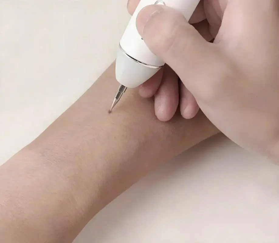 Aparat indepartare papiloame/pete/negi Xpreen 125952 (White)