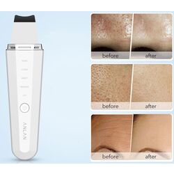 Spalator cu ultrasunete Anlan ALCPJ06-02 (White) Thumb