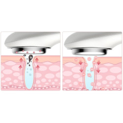 Aparat pentru îngrijirea feței TouchBeauty TB-1981K (White/Pink) Thumb