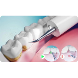 Scaler Berdsen BD-251 325100 (Inox/White) Thumb