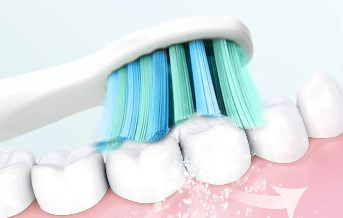 Set periute de dinti sonice FairyWill FW-507 (Black/Pink)