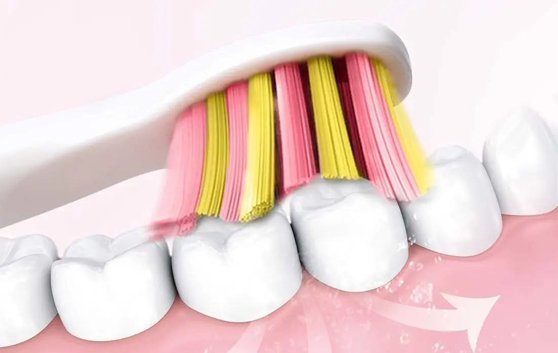 Periuta de dinti sonica FairyWill FW-507 Plus (Pink)