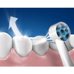 Irigator Oral-B Professional Care OxyJet MD20 (White/Blue) Thumb