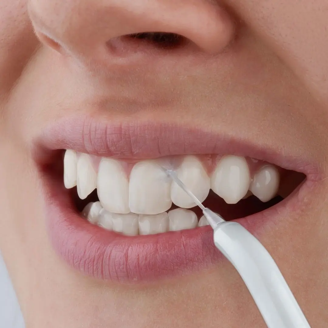 Irigator Sencor SOI 2201RS (Pink) - 9