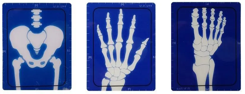 Игровой набор LeanToys X-ray Doctor (Turquoise) - 5