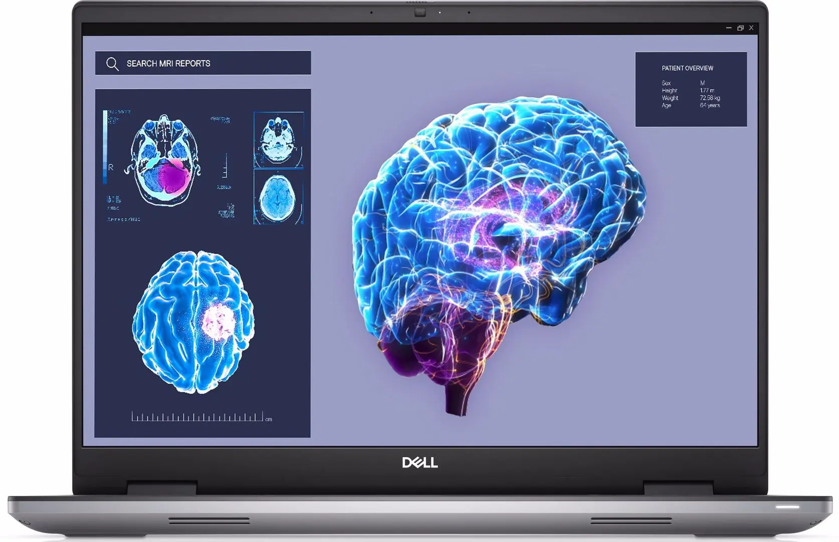 Laptop Dell Precision 7680 Intel Core i7-13850HX 32GB DDR5/1TB SSD W11P (Grey)