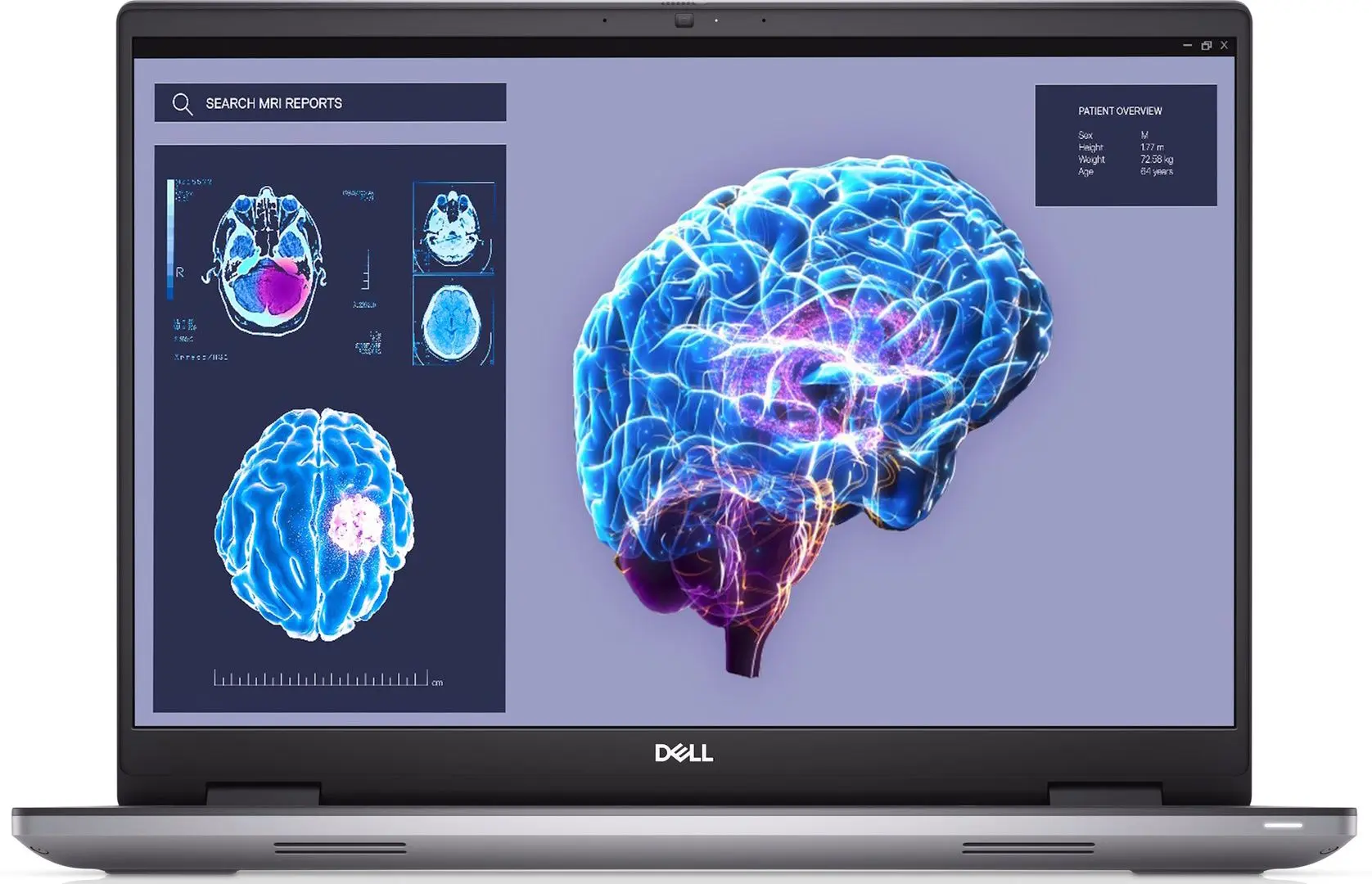 Laptop Dell Precision 7680 Workstation Intel Core i9-13950HX 32GB DDR5/1TB SSD (Gray)