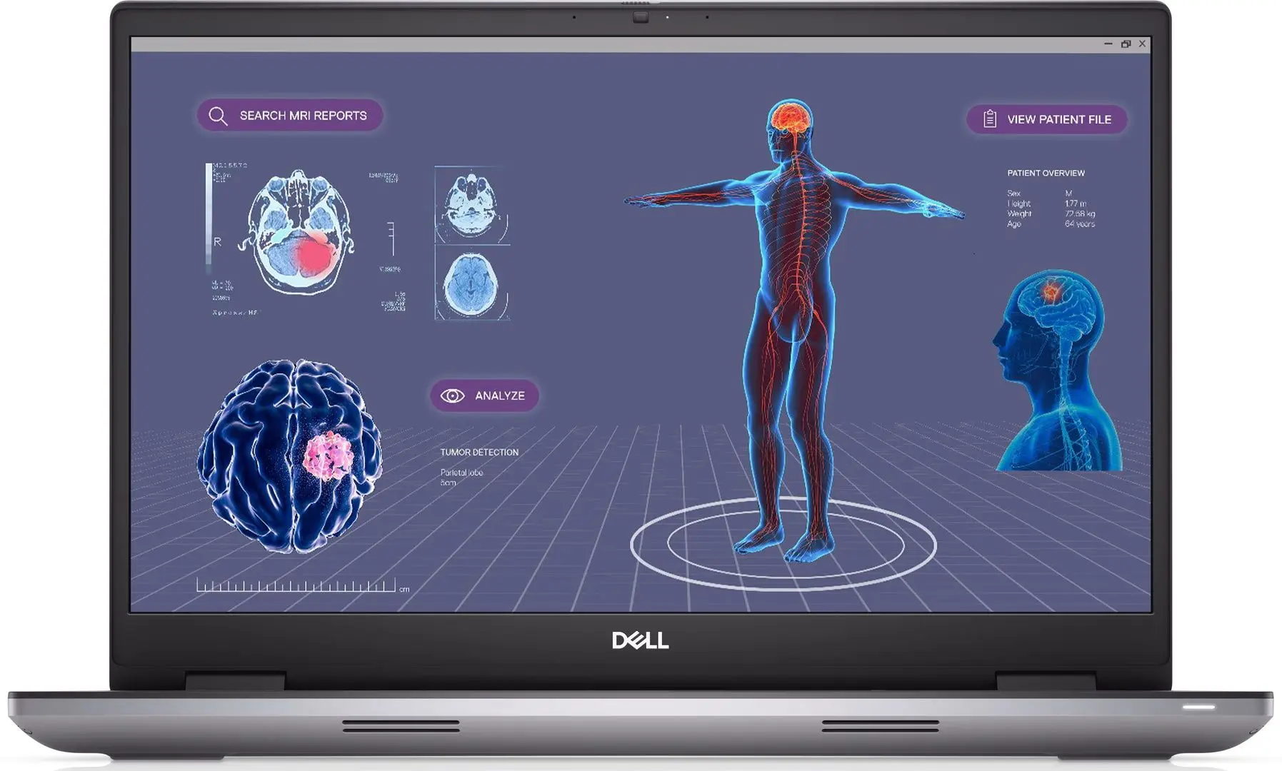 Ноутбук Dell Precision 7780 Intel Core i7-13850HX 16GB DDR5/512GB SSD W11P (Grey)