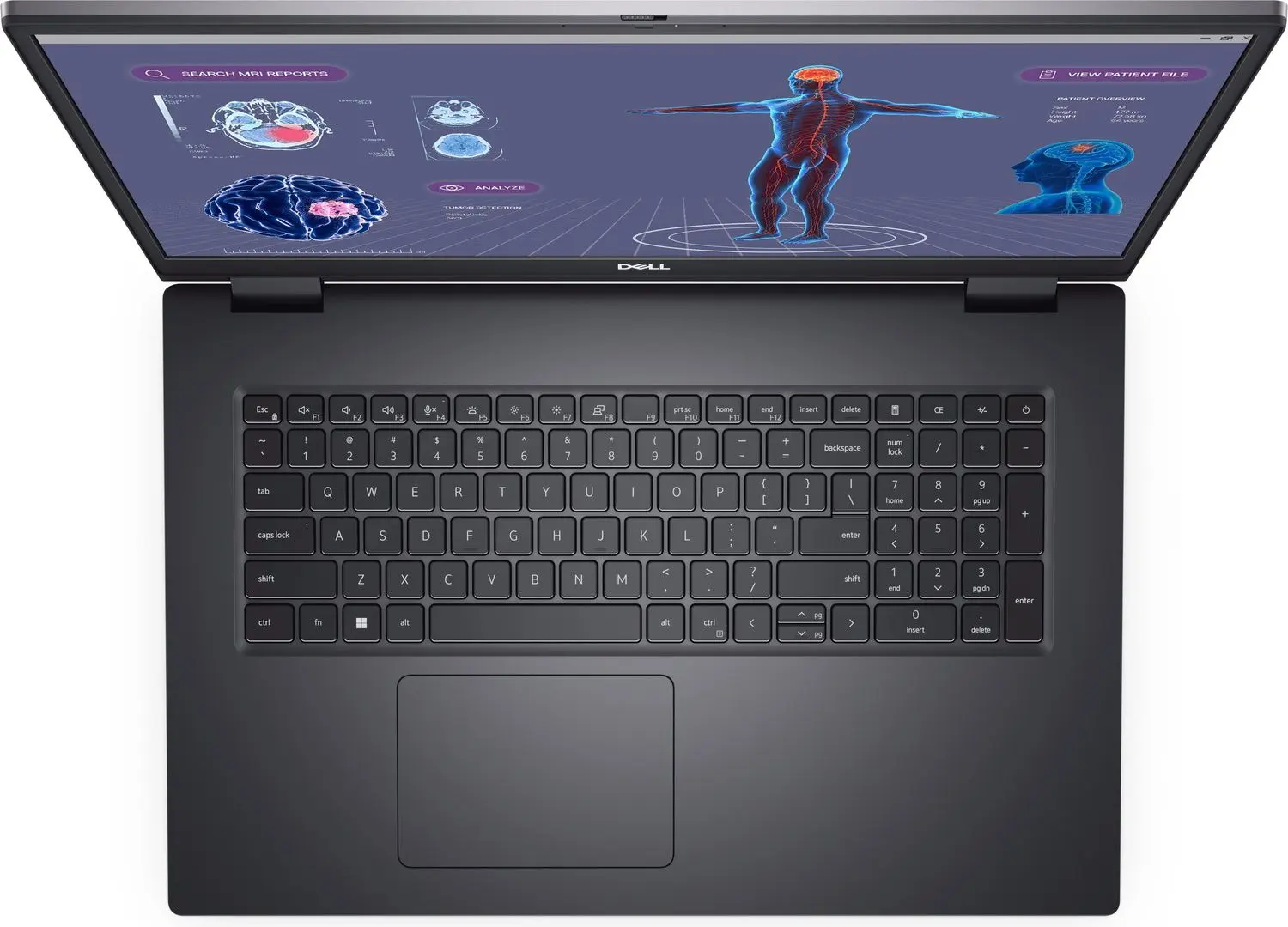 Laptop Dell Precision 7780 Intel Core i9-13950HX 32GB DDR5/1TB SSD W11P (Grey)